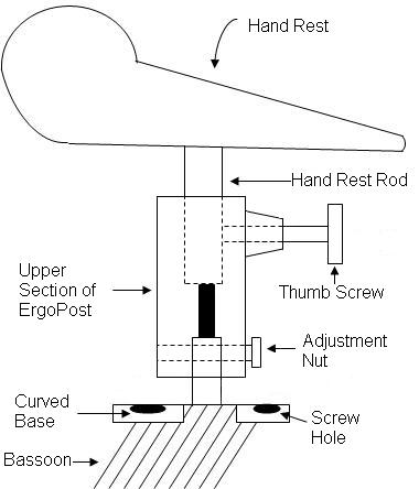 ErgoPost Figure